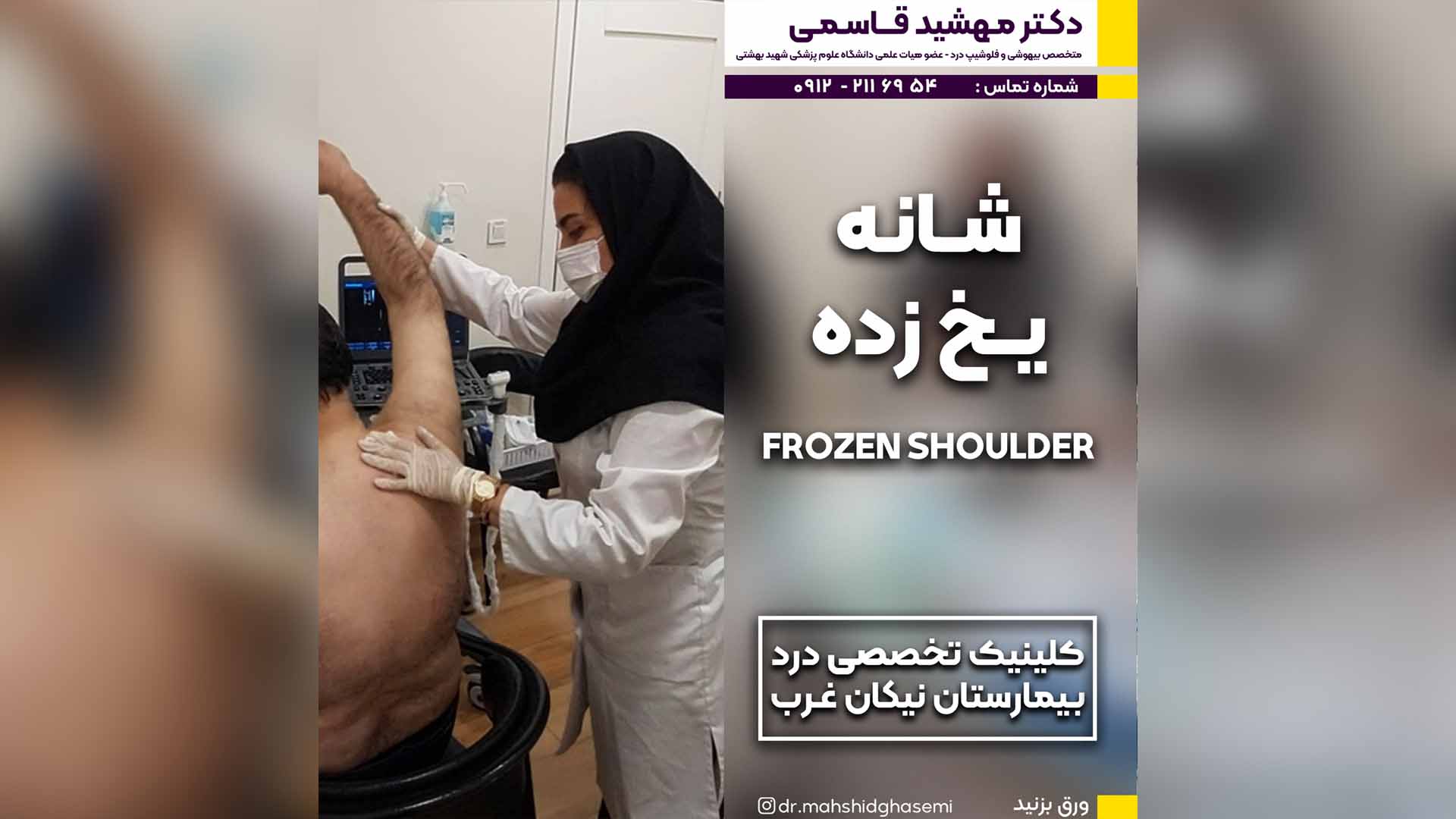 شانه یخ زده