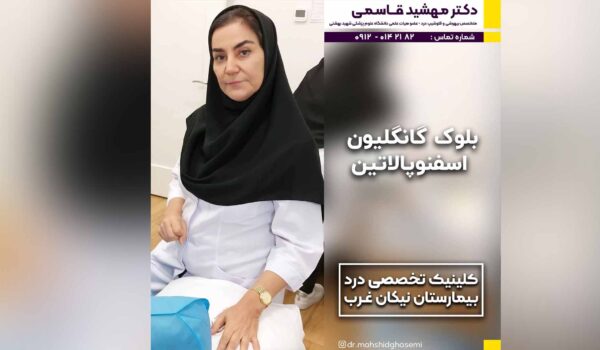 بلوک گانگلیون اسفنوپالاتین